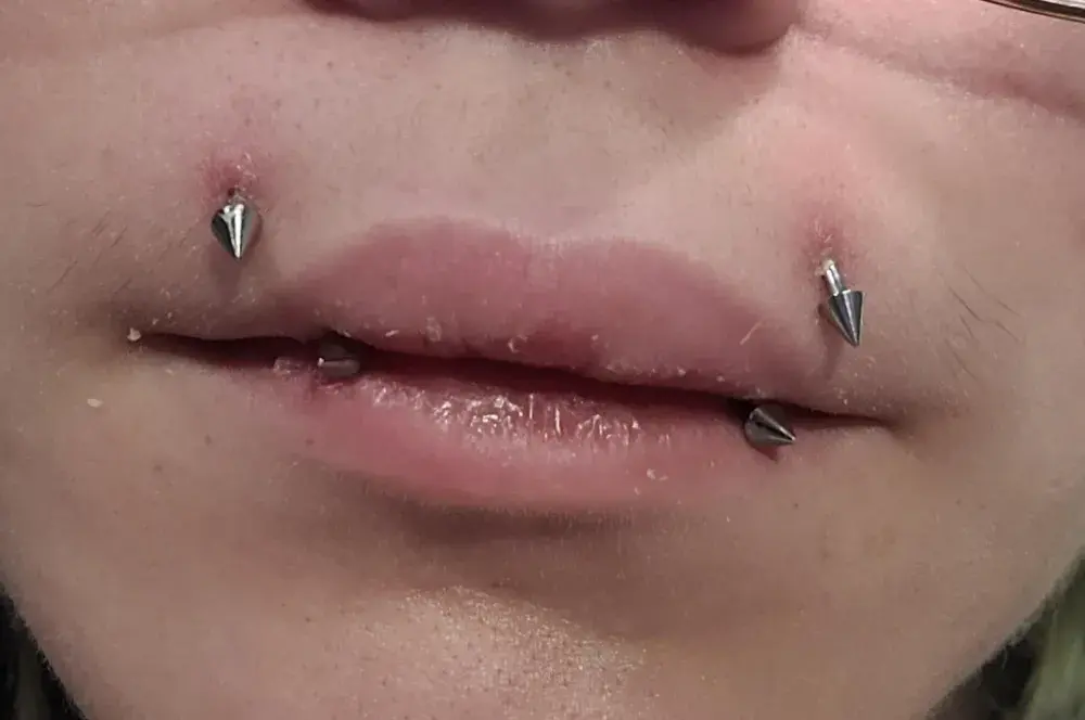 Jak dbać o angel bites piercing i uniknąć problemów?