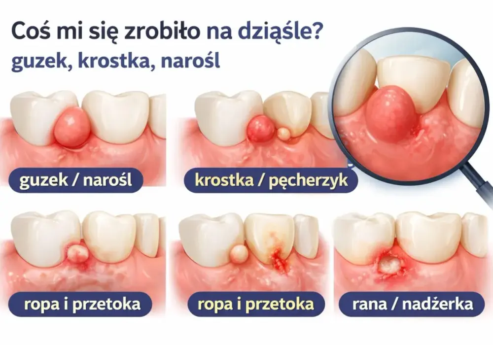 Guzek przy helixie - Czy to ziarnina? Rozpoznaj i działaj!