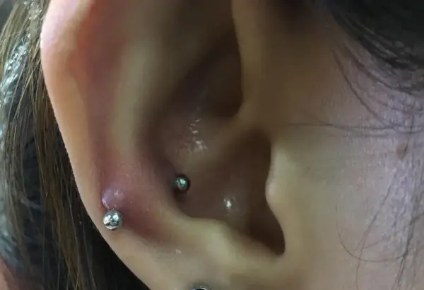 Snug piercing - czy Twoje ucho się nadaje? Ból i gojenie